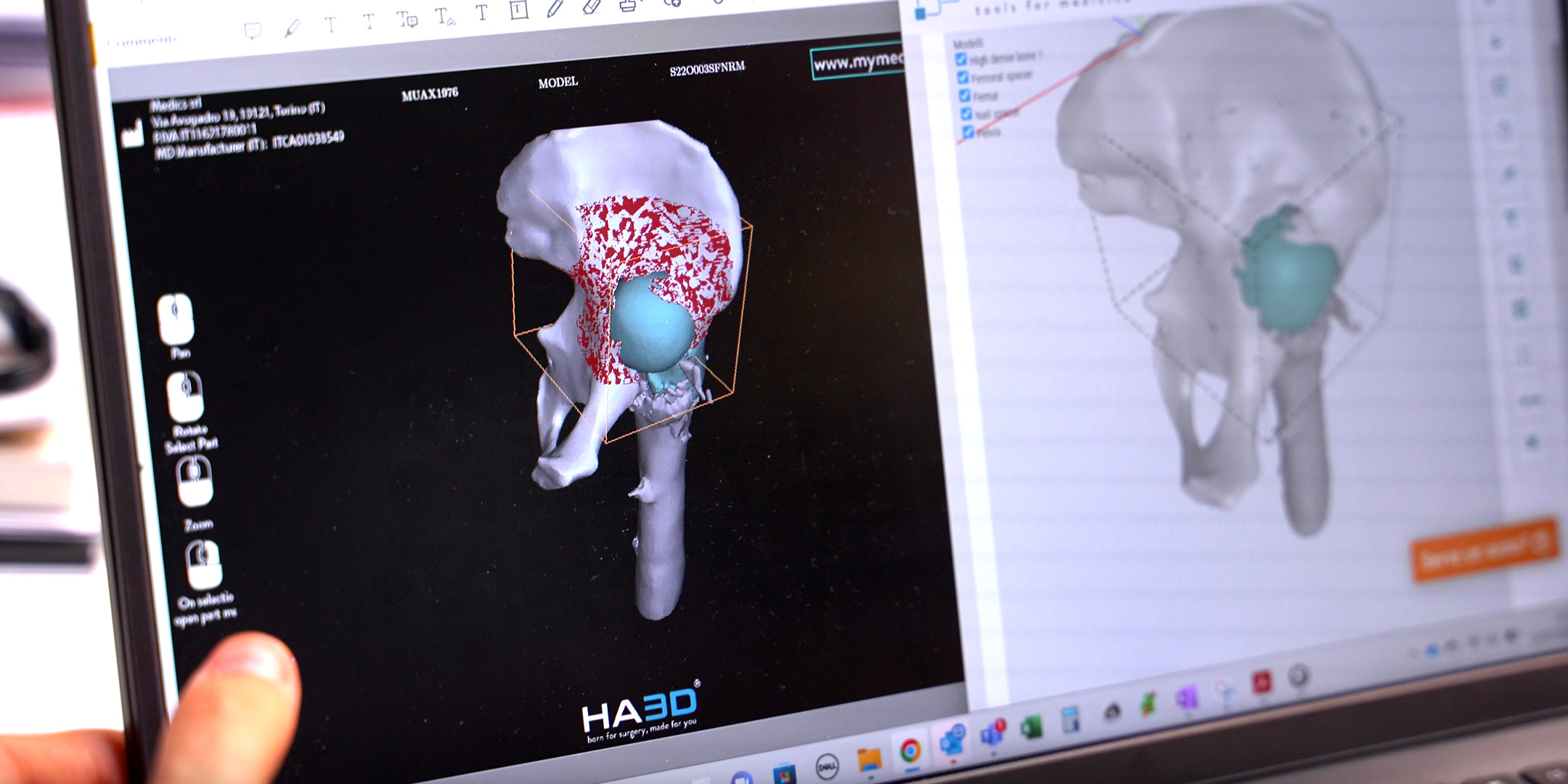 Patients' DICOM scan data is imported to create accurate 3D representations of the anatomical area